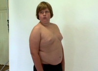 Battling Obesity <b> NL première + SHORT</b>